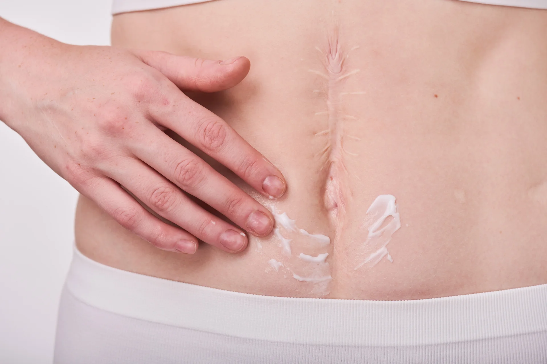 woman applying cream on belly 2026 03 09 01 51 39 utc
